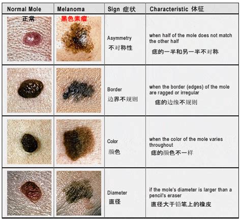 黑獅子 身上有痣